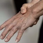 Formigamento nas mãos e pés ou Parestesia